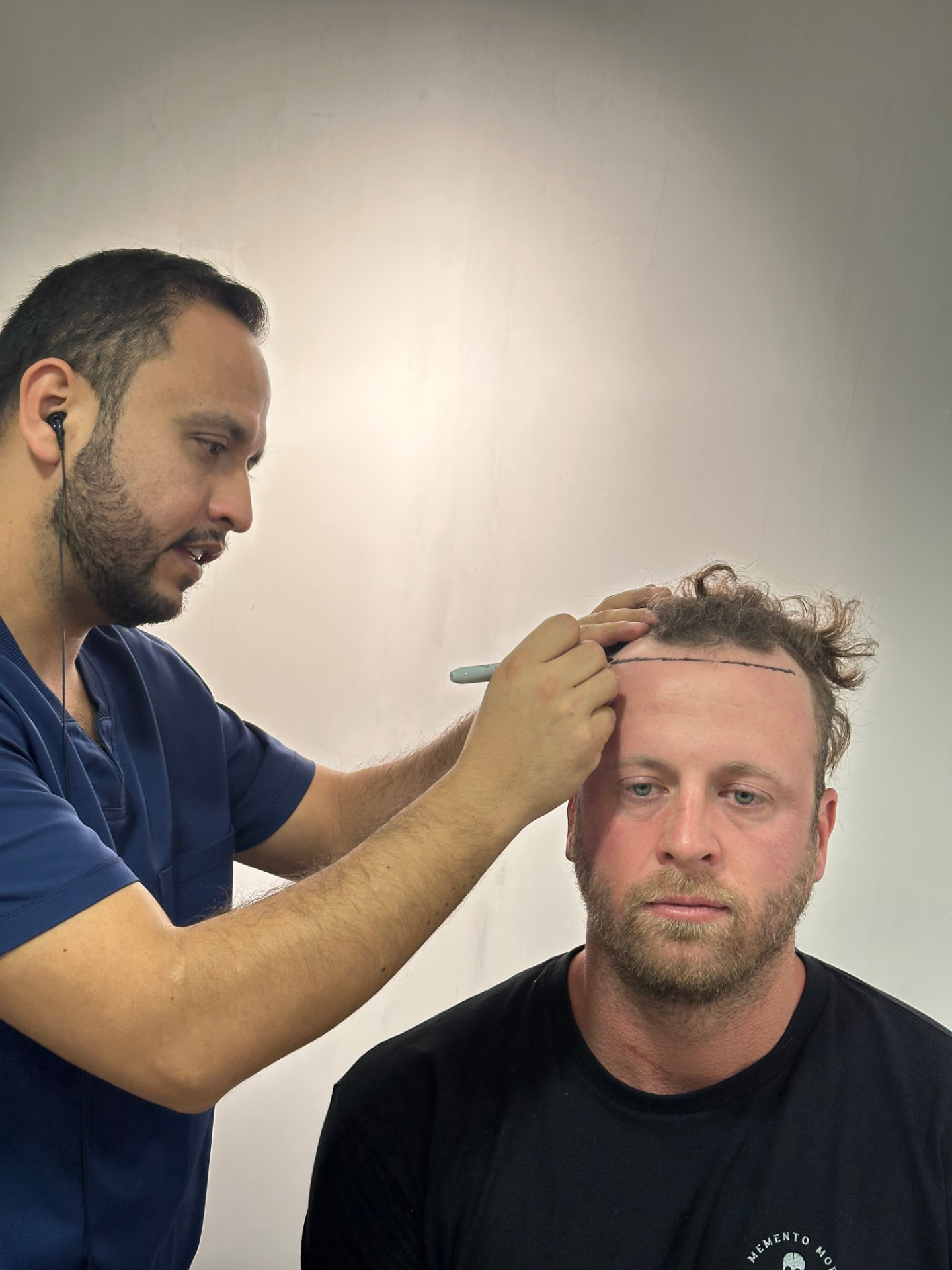 The founder having his own hairline mapped out before his transplant at Encore Bogotá