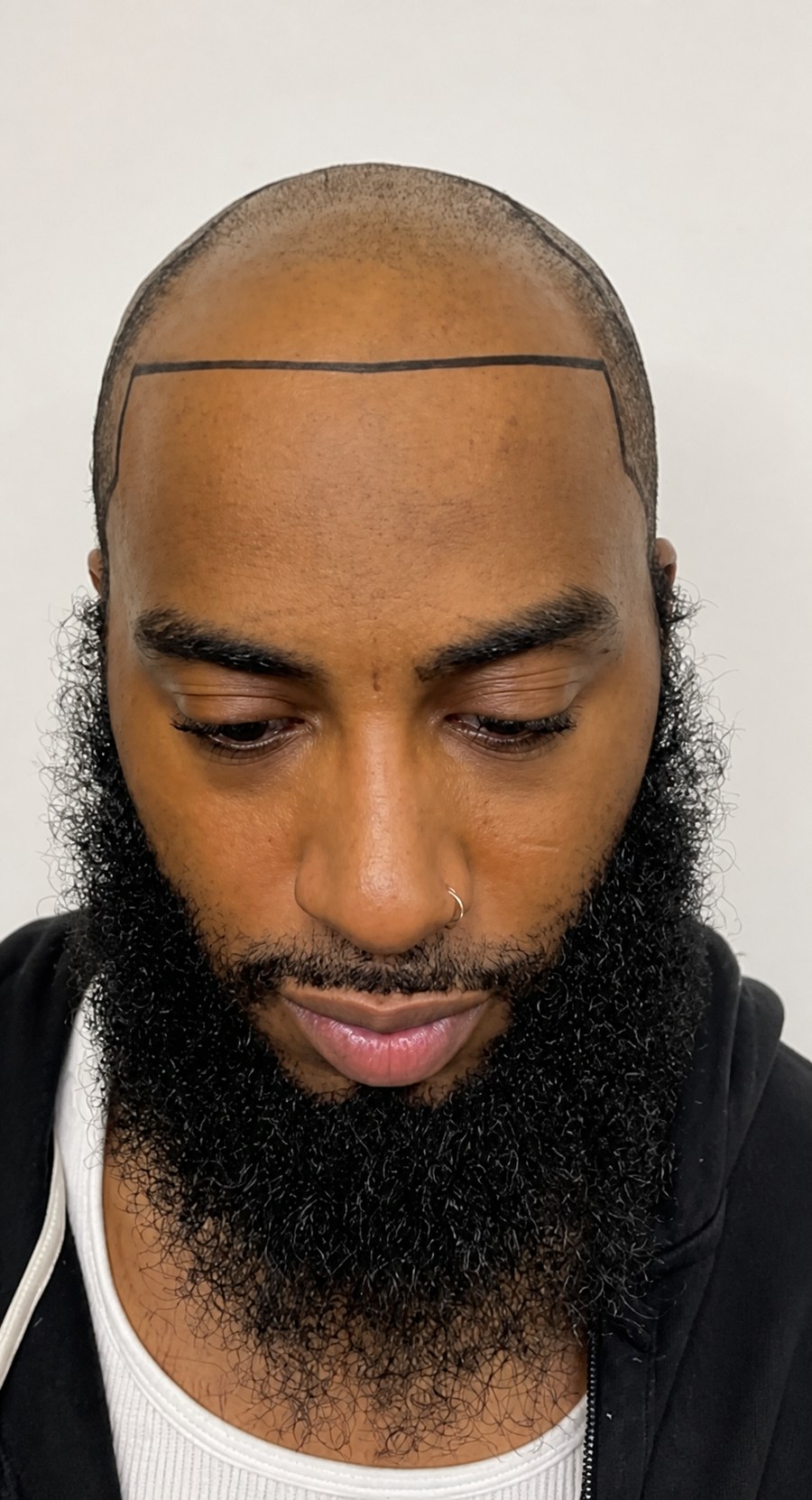 Example of a hairline drawn as one straight ruler line across the forehead
